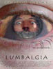 Lumbalgia