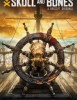 Skull and bones