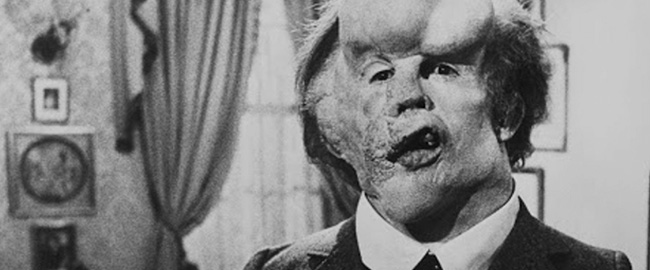 Jack Huston dirigirá “Joseph Merrick”, una nueva visión sobre la historia del “Hombre Elefante”